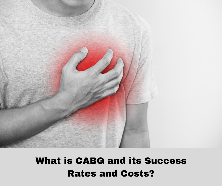 CABG Surgery in India