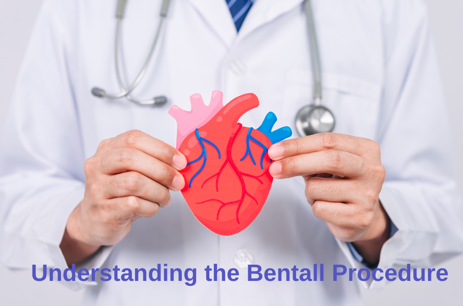 Bentall Procedure in Delhi